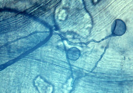 File:TournanFungalBackground.jpg