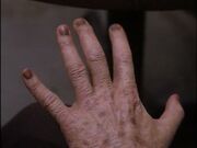Javna's hand aging rapidly