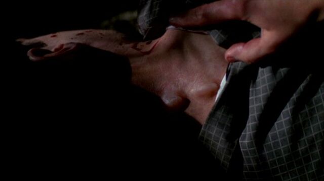 File:Bloodied Billy Miles' neck.jpg