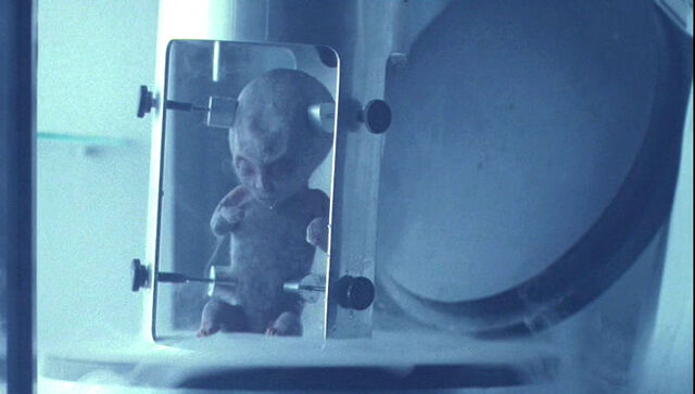 File:Fetus.jpg