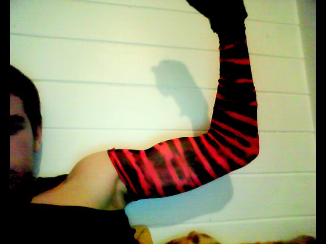 File:My new arm look.jpg
